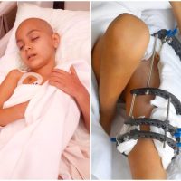 Update – 23.01.2026, Rares are nevoie de bani pentru o noua interventie